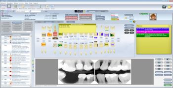De inhaalslag in tandheelkundige software