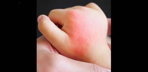 Video Connect door Vcare