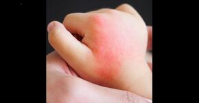 Video Connect door Vcare