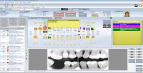 De inhaalslag in tandheelkundige software