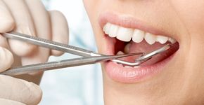 Lage inkomens minder vaak naar de tandarts