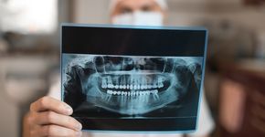 IGZ controleert gebruik röntgenfoto's in de mondzorg