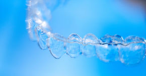 Koningin Máxima draagt onzichtbare beugel