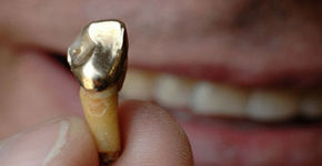 Dental Gold bv waardevol voor tandarts én milieu