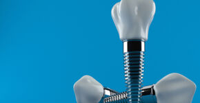 Bezuiniging op implantaten ten koste van kwaliteit