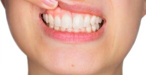 Tandartsen stellen praktijk open voor Dag van het Tandvlees