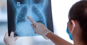 Algemene Rekenkamer: ‘Sturen op zinnige zorg veranderde praktijk niet’